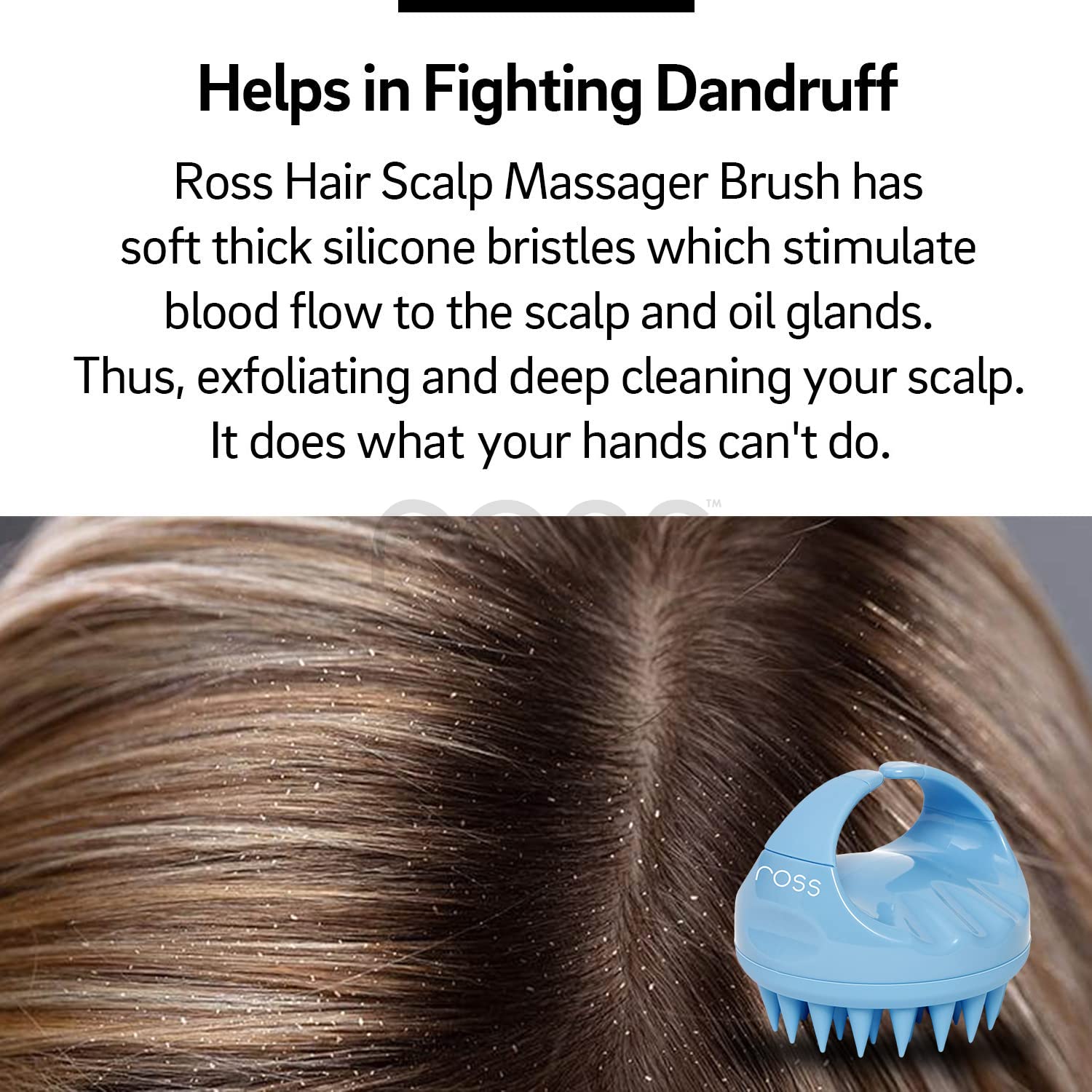 Ross Hair Scalp Massager Shampoo Brush with Soft Silicone Bristles